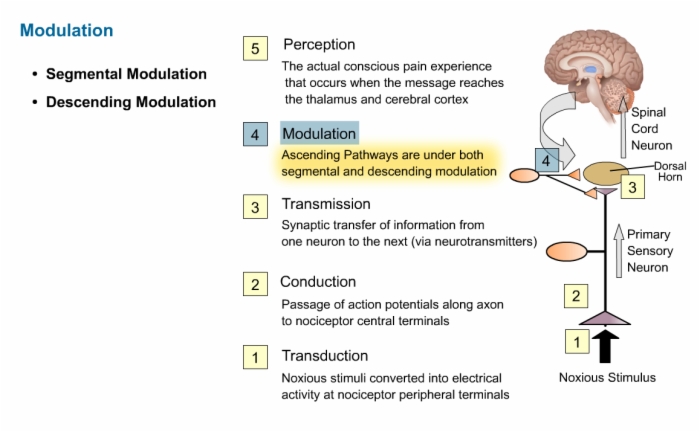 Neurology_Pain_Process