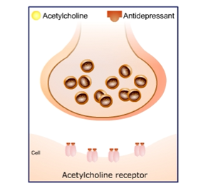 Xerostomia is dry mouth resulting from reduced or absent saliva flow, typically caused by medications inclusing diuretics, anti-depressants, and antihistamines. 